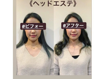 周りが見てわかる小顔効果♪_20190317_1
